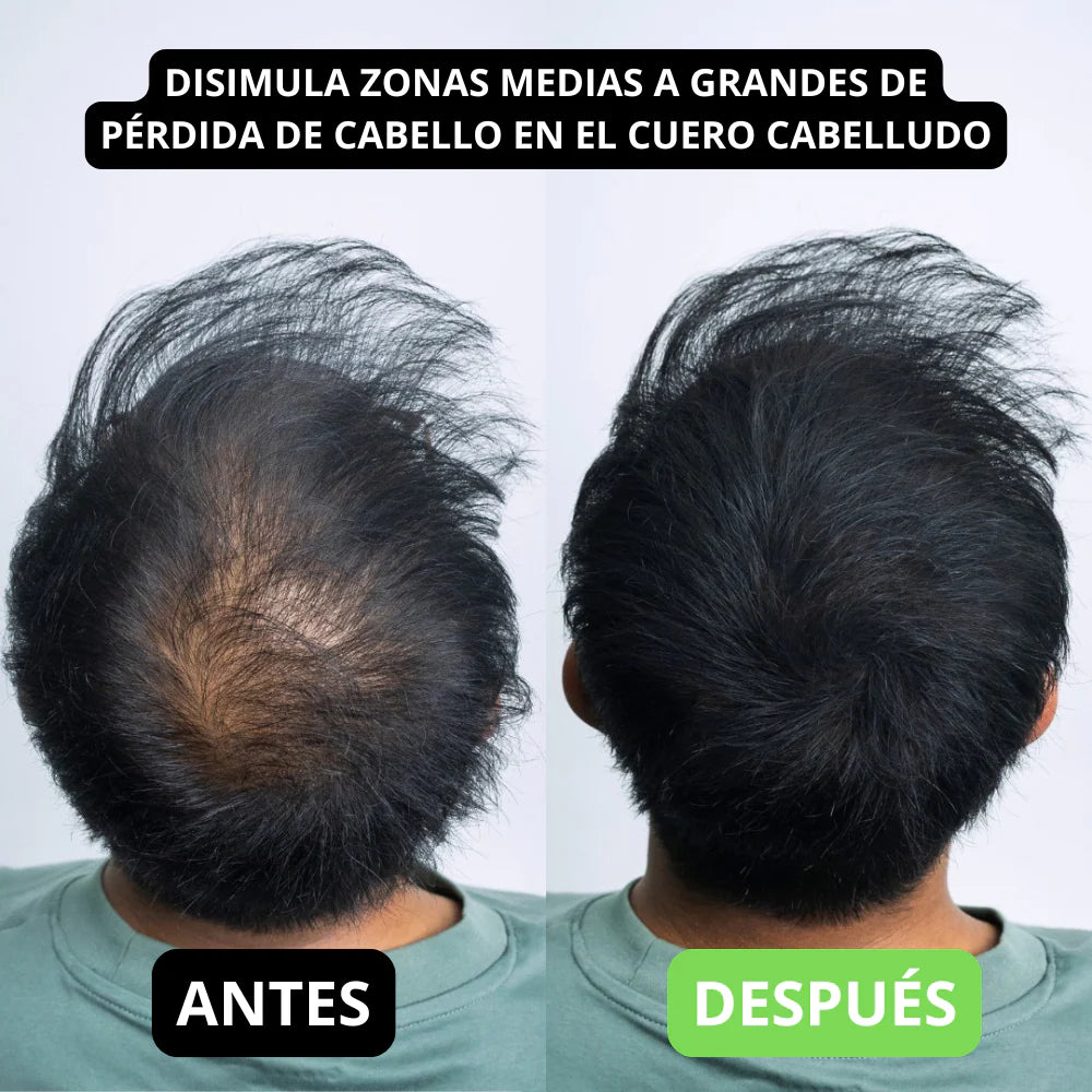 Hair Volume Powder for Men & women