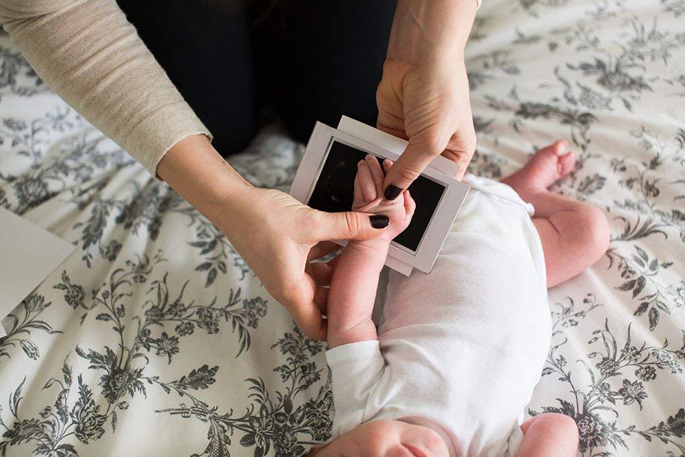 Tiny Memories – Inkless Baby Hand & Footprint Kit (Safe)