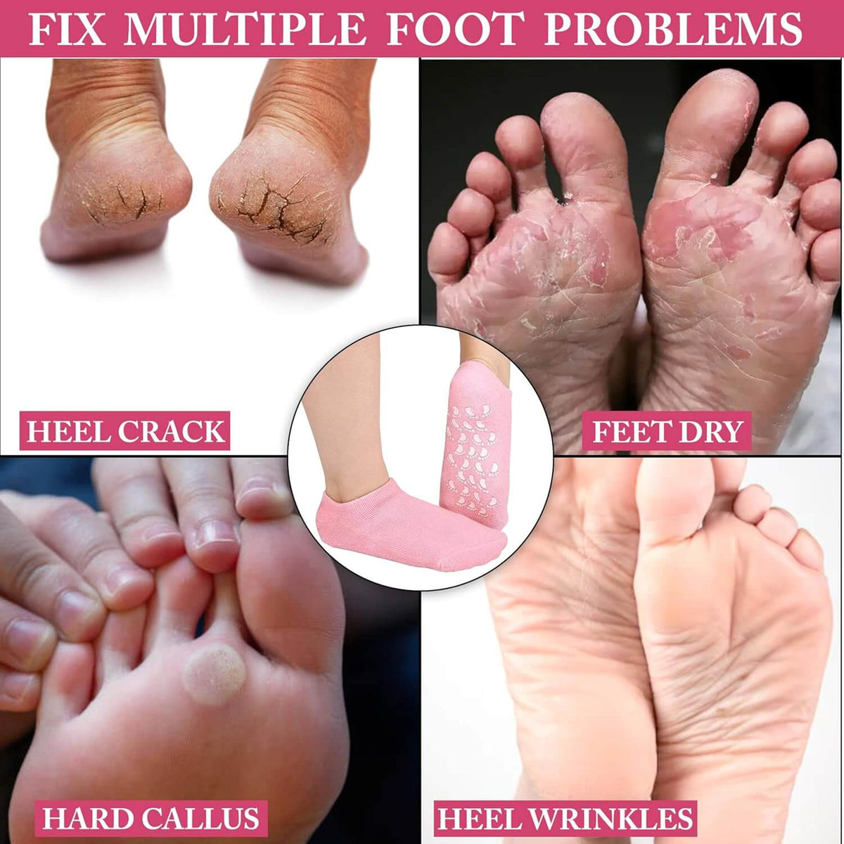 SPA GEL MOISTURIZING FOOT CARE SOCKS