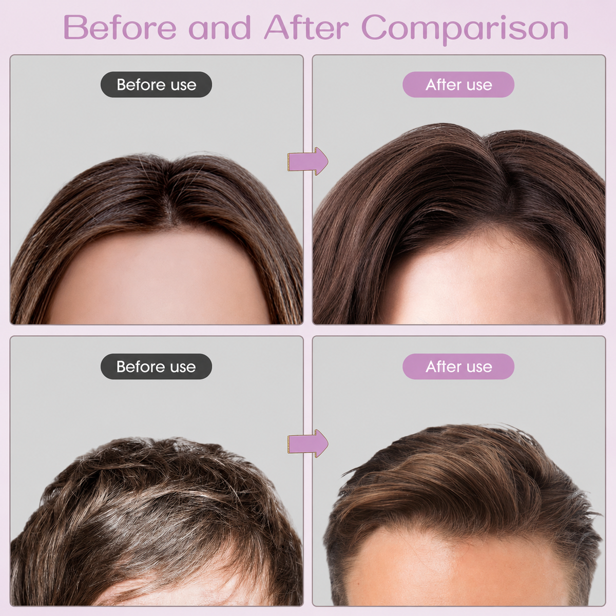 Hair Volumizing Clips