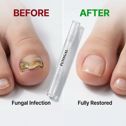 2 In 1 Anti-aging Nail Fungus Repair Pen