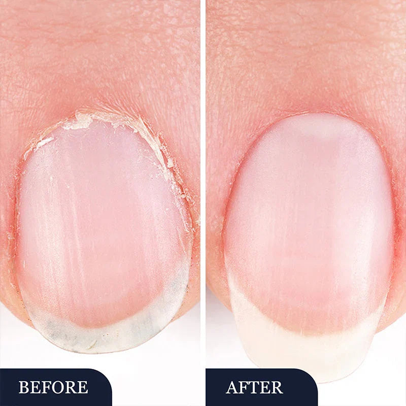2 In 1 Anti-aging Nail Fungus Repair Pen